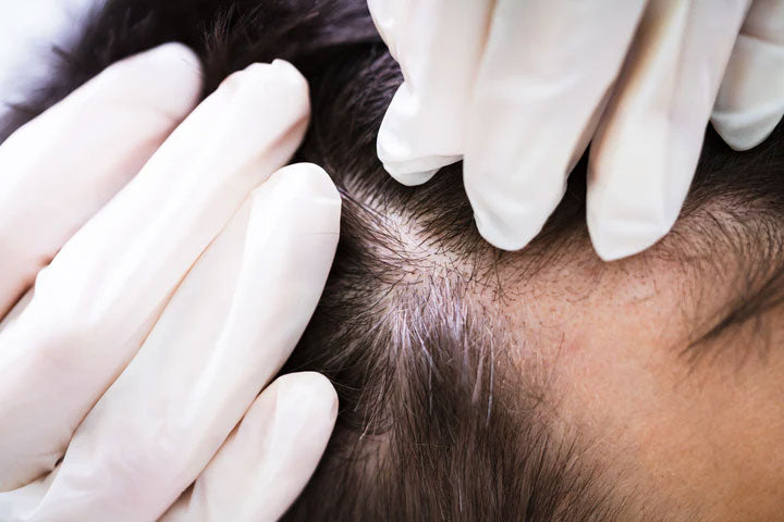 Mobile Lice Service – Discreet, Convenient & Stress-Free!