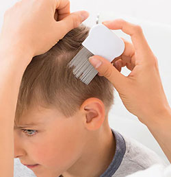 Facts of lice